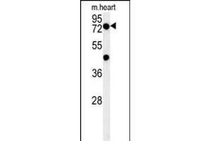PHTF2 Antibody (Center) (ABIN654395 and ABIN2844137) western blot analysis in mouse heart tissue lysates (15 μg/lane). (PHTF2 抗体  (AA 420-448))
