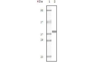 Western blot analysis using Myoglobin antibody against truncated Myoglobin recombinant protein (AA: 2-154). (Myoglobin 抗体)