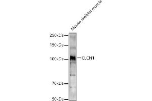 Western blot analysis of extracts of Mouse skeletal muscle, using CLCN1 antibody (ABIN6130939, ABIN6138661, ABIN6138662 and ABIN6221409) at 1:1000 dilution. (CLCN1 抗体  (AA 779-988))