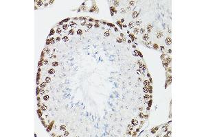Immunohistochemistry of paraffin-embedded rat testis using CPSF6 Rabbit pAb (ABIN6128924, ABIN6138974, ABIN6138975 and ABIN6221646) at dilution of 1:100 (40x lens). (CPSF6 抗体)