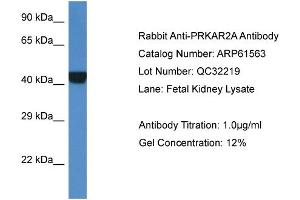 Western Blotting (WB) image for anti-Protein Kinase, CAMP-Dependent, Regulatory, Type II, alpha (PRKAR2A) (Middle Region) antibody (ABIN2788839)