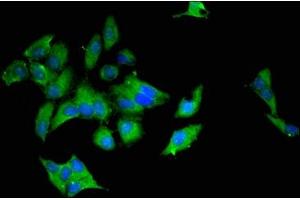 Immunofluorescent analysis of Hela cells using ABIN7174579 at dilution of 1:100 and Alexa Fluor 488-congugated AffiniPure Goat Anti-Rabbit IgG(H+L) (UBE2L6 抗体  (AA 13-153))