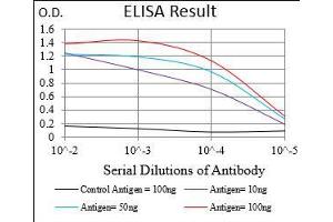 Black line: Control Antigen (100 ng), Purple line: Antigen(10 ng), Blue line: Antigen (50 ng), Red line: Antigen (100 ng), (HDAC10 抗体  (AA 18-219))