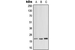 Western blot analysis of MRPL12 expression in HeLa (A), SP2/0 (B), H9C2 (C) whole cell lysates. (MRPL12 抗体  (Center))
