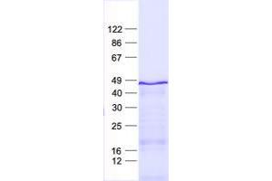 Western Blotting (WB) image for Zinc Finger Protein 621 (ZNF621) protein (His tag) (ABIN2736086)