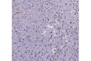 anti-Eukaryotic Translation Elongation Factor 2 (EEF2) (N-Term) antibody