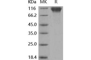 Western Blotting (WB) image for Selectin L (SELL) (Active) protein (His tag,Fc Tag) (ABIN7197875)