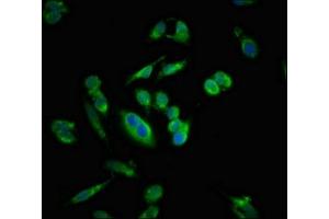 Immunofluorescent analysis of Hela cells using ABIN7160870 at dilution of 1:100 and Alexa Fluor 488-congugated AffiniPure Goat Anti-Rabbit IgG(H+L) (SIRT5 抗体  (AA 60-212))