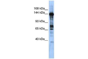 WB Suggested Anti-CASZ1 Antibody Titration:  0. (CASZ1 抗体  (Middle Region))
