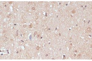 Immunohistochemistry of paraffin-embedded Rat brain using NAA20 Polyclonal Antibody at dilution of 1:100 (40x lens). (NAT5 抗体)