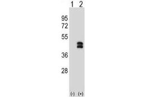 Western blot analysis of DUSP6 antibody and 293 cell lysate either nontransfected (Lane 1) or transiently transfected (2) with the DUSP6 gene. (DUSP6 抗体  (AA 59-88))