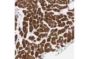 Immunohistochemical staining of human heart muscle with KIF21B polyclonal antibody  shows strong cytoplasmic positivity in myocytes at 1:50-1:200 dilution. (KIF21B 抗体)