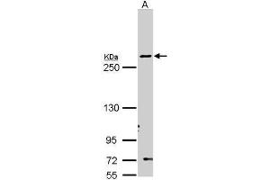 WB Image Sample (30 ug of whole cell lysate) A: Molt-4 , 5% SDS PAGE antibody diluted at 1:1000 (Fatty Acid Synthase 抗体  (N-Term))