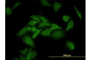 Immunofluorescence of monoclonal antibody to ANKRA2 on HeLa cell. (ANKRA2 抗体  (AA 1-98))