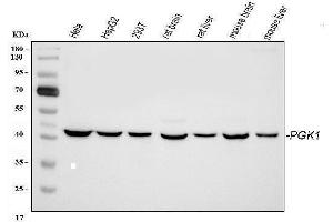 Western blot analysis of PGK1 using anti-PGK1 antibody (ABIN3043604).