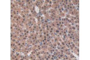 IHC-P analysis of liver tissue, with DAB staining. (beta-Thromboglobulin 抗体  (AA 46-107))