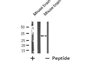 Western blot analysis of MARCKS expression in Mouse brain tissue lysates,The lane on the left is treated with the antigen-specific peptide. (MARCKS 抗体  (Internal Region))