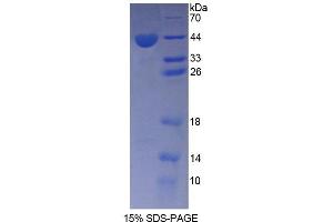 SDS-PAGE analysis of Rat AGTR1 Protein. (Angiotensin II Type-1 Receptor 蛋白)