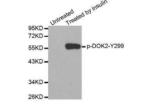 Western blot analysis of extracts from Jurkat cells using Phospho-DOK2-Y299 antibody (ABIN2987731). (DOK2 抗体  (pTyr299))