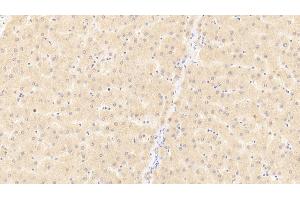 Detection of CD40L in Human Liver Tissue using Polyclonal Antibody to Cluster Of Differentiation 40 Ligand (CD40L) (CD40 Ligand 抗体  (AA 1-261))