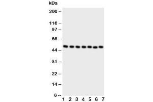 Western blot testing of CTBP2 antibody and Lane 1:  rat brain;  2: rat spleen ;  3: HeLa;  4: 293T;  5: COLO320;  6: U87;  7: SW620 cell lysate (CTBP2 抗体  (C-Term))