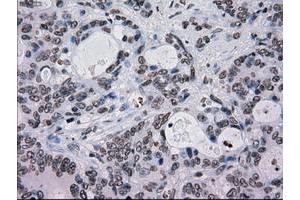 Image no. 4 for anti-TYRO3 Protein Tyrosine Kinase (TYRO3) antibody (ABIN1501607)