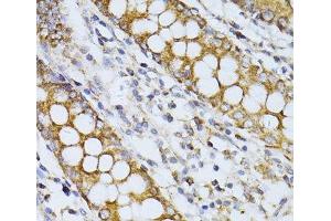 Immunohistochemistry of paraffin-embedded Human colon using CCDC92 Polyclonal Antibody at dilution of 1:100 (40x lens). (CCDC92 抗体)