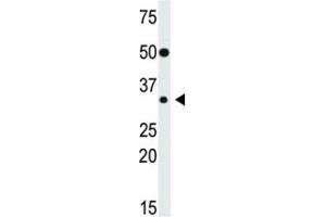 Western blot testing of SLUG antibody and mouse heart lysate.