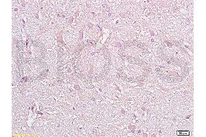 Formalin-fixed and paraffin embedded rat brain tissue with labeled Anti-CD38 Polyclonal Antibody, Unconjugated (ABIN730498) at 1:200, followed by conjugation to the secondary antibody and DAB staining (CD38 抗体  (AA 101-200))