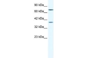 Western Blot showing ZNF660 antibody used at a concentration of 1-2 ug/ml to detect its target protein. (ZNF660 抗体  (C-Term))