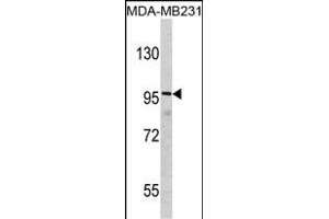 Western blot analysis of DLG Antibody (N-term) (ABIN390832 and ABIN2841058) in MDA-M cell line lysates (35 μg/lane). (DLGAP1 抗体  (N-Term))