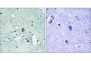 Immunohistochemistry (IHC) image for anti-Inositol 1,4,5-Trisphosphate Receptor, Type 1 (ITPR1) (AA 1730-1779), (pSer1764) antibody (ABIN1532147)