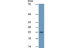 Rabbit Detection antibody from the kit in WB with Positive Control:  Sample Mouse heart lysate. (IGF1 ELISA 试剂盒)