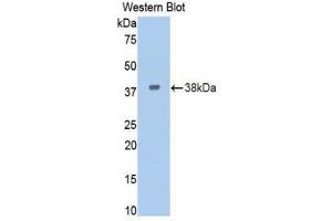 Western Blotting (WB) image for anti-Insulin Receptor (INSR) (AA 622-945) antibody (ABIN3207587) (Insulin Receptor 抗体  (AA 622-945))