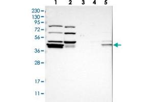 Western blot analysis of Lane 1: RT-4, Lane 2: U-251 MG, Lane 3: Human Plasma, Lane 4: Liver, Lane 5: Tonsil with RDBP polyclonal antibody  at 1:250-1:500 dilution. (RDBP 抗体)