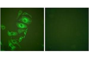 Immunofluorescence analysis of HepG2 cells, using Keratin 17 Antibody. (KRT17 抗体  (AA 381-430))