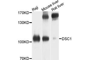 Western blot analysis of extracts of various cells, using DSC1 antibody. (Desmocollin 1 抗体)