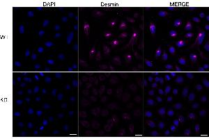 Immunocytochemical staining of HeLa cells using Desmin antibody (ABIN7798314), 1:1,000), Top panel: wild-type (WT), Bottom panal: Desmin shRNA knockdown (KD). (Recombinant Desmin 抗体)