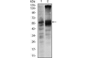 Western blot analysis using SOX9 mouse mAb against Lovo (1) and SW620 (2) cell lysate. (SOX9 抗体)