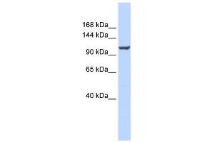 ATP2B4 antibody used at 1 ug/ml to detect target protein. (ATP2B4 抗体  (Middle Region))