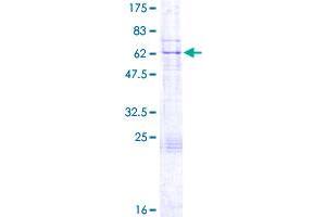 KATNA1 Protein (AA 1-311) (GST tag)