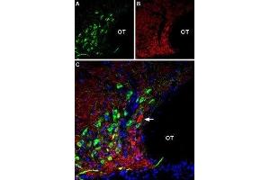 Immunohistochemistry (IHC) image for anti-Solute Carrier Family 17 (Vesicular Glutamate Transporter), Member 6 (SLC17A6) (AA 45-56), (Cytosolic) antibody (Atto 594) (ABIN7043682)