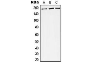 Western blot analysis of Complement C4A/B expression in A549 (A), Raw264. (Complement C4A/C4B (Center) 抗体)