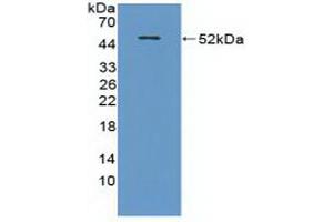 Western blot analysis of recombinant Mouse CRAT. (CRAT 抗体  (AA 1-430))