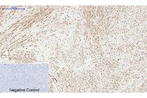 Immunohistochemical analysis of paraffin-embedded human uterus tissue. (PERK 抗体  (pThr981))