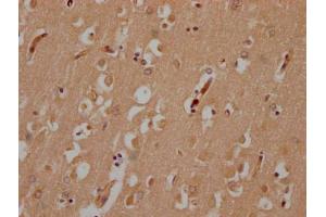 IHC image of ABIN7174973 diluted at 1:200 and staining in paraffin-embedded human brain tissue performed on a Leica BondTM system.