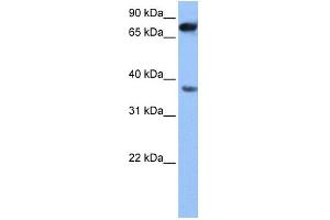 WB Suggested Anti-ZCCHC12 Antibody Titration: 0. (ZCCHC12 抗体  (N-Term))