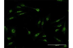 Immunofluorescence of monoclonal antibody to SUMO3 on HeLa cell. (SUMO3 抗体  (AA 1-103))