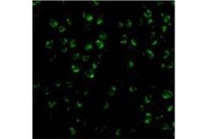 Immunofluorescence of ASK1 in 3T3 cells with AP30086PU-N ASK1 antibody at 20 μg/ml. (ASK1 抗体)