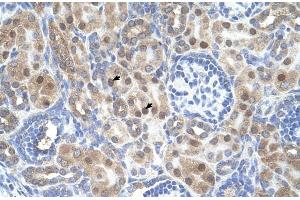 Human kidney; ARMCX6 antibody - N-terminal region in Human kidney cells using Immunohistochemistry (ARMCX6 抗体  (N-Term))